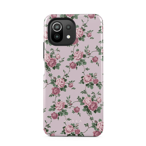 AL_04_XiaomiMI11Lite_TH